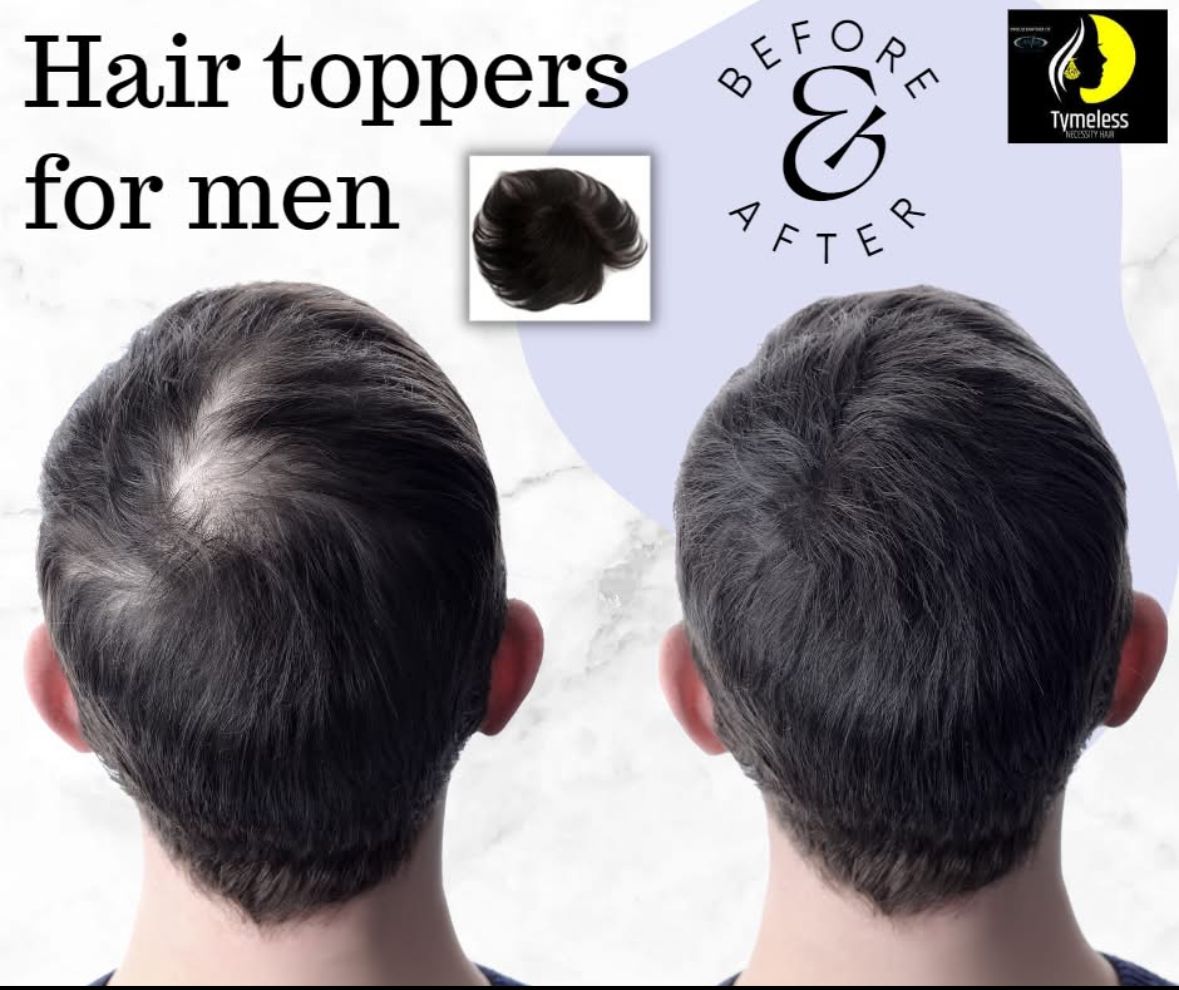 Men's Hair System